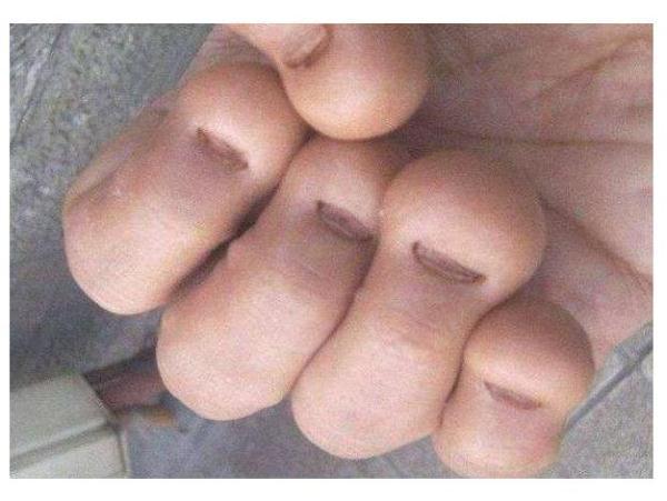 孩子咬指甲的三大危害 孩子咬指甲的三大危害