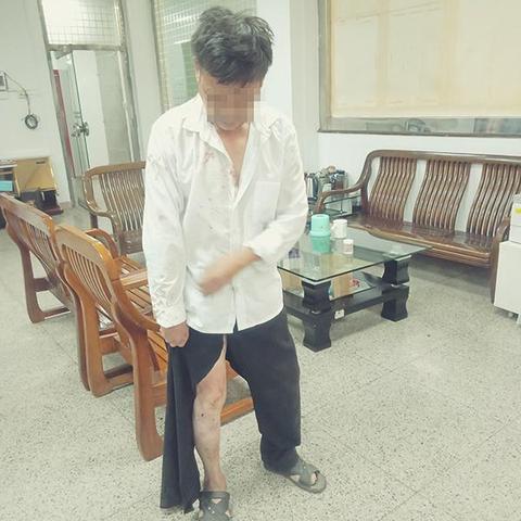 回广东省佛山市要隔离吗的长尾关键词有哪些