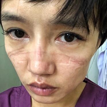 哈尔滨护士工作好找吗相关长尾关键词有哪些