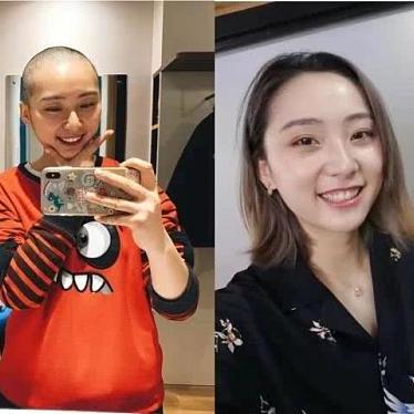 看头发宁波哪个医院好的相关长尾关键词有哪些