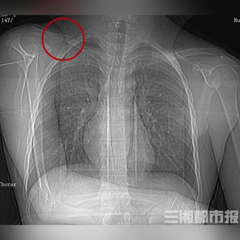 长沙市望城区下雪要停课吗？