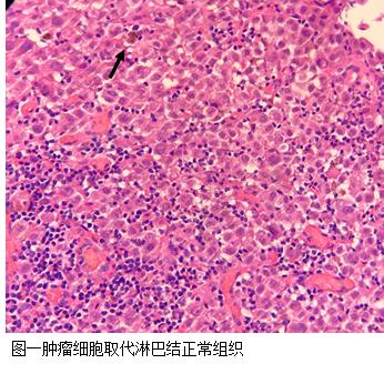 杭州哪里点痣好点？