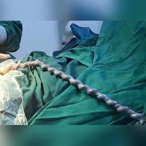 【桂林今日黄金价格】2025年6月8日桂林黄金价格是多少