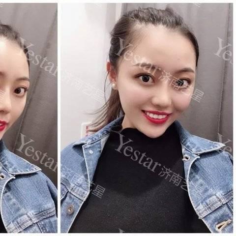 济南艺星整形医院怎么样相关长尾关键词有哪些