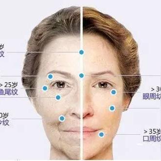 济南除皱手术相关长尾关键词有哪些