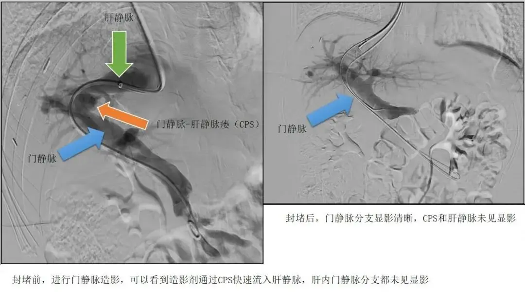 cps今年还在吗 快手秀娥还在吗