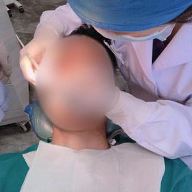 长沙口腔医院拔智齿多少钱相关长尾关键词有哪些