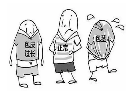 包皮手术会影响性生活吗 包皮手术会影响性生活吗