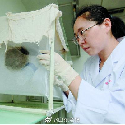 济南市疾控中心可以查什么