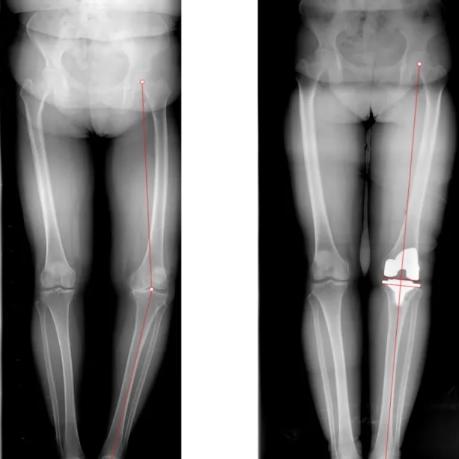 怎么做一个人工智能数据