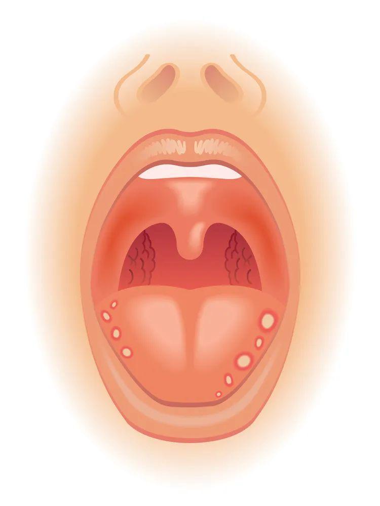 口腔疾病防治参考文献的写法如何当好一名口腔医生