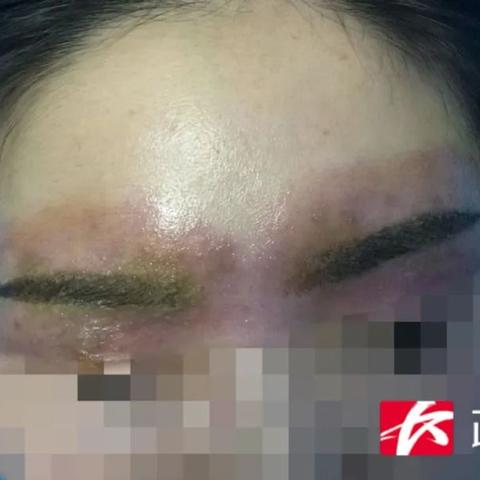 长沙皮肤科最好的医院相关长尾关键词有哪些