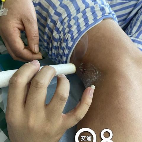 杭州市看膝盖哪个医院好