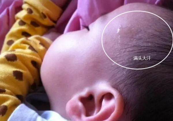 为什么宝宝睡觉总是流汗