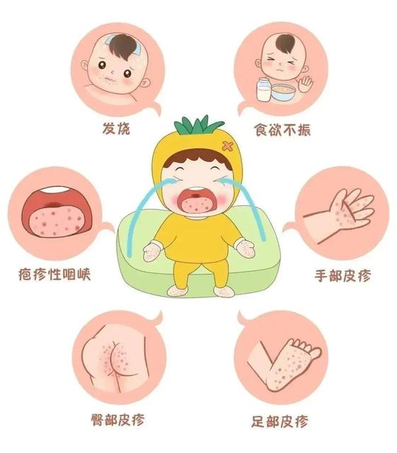宝宝发烧嗜睡正常吗