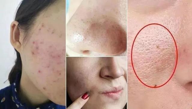 宝宝在外面玩弄脏了可以用洗面奶吗