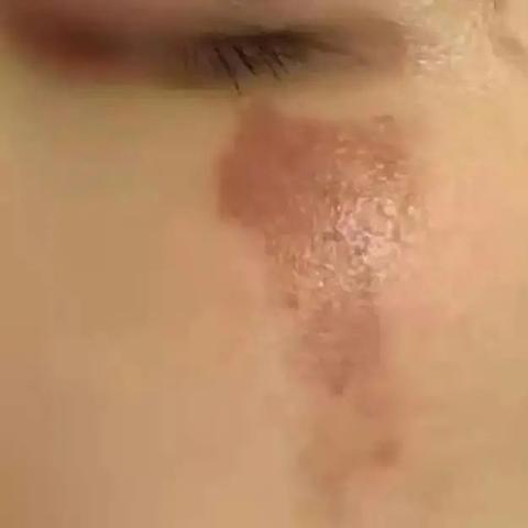 福建毁容少女将换脸化妆的相关长尾关键词有哪些