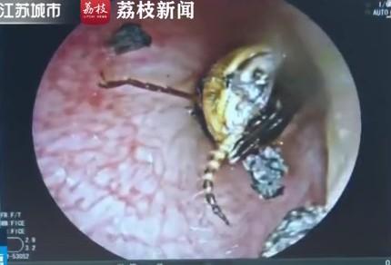 宝宝耳朵鼻子有异物怎么办