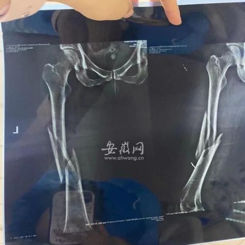 合肥哪里的瑜伽馆比较好啊？