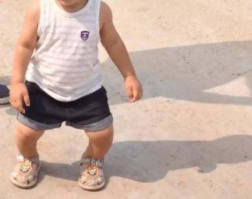 孩子腿型发育规律