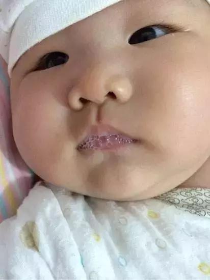 宝宝吐泡泡就是肺炎吗
