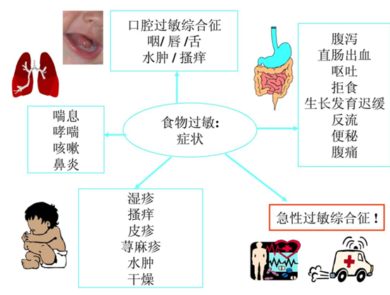 怎么判断宝宝是不是过敏性体质