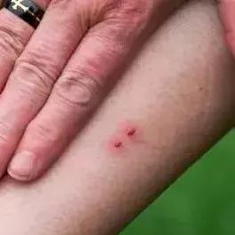 河南毒蛇血清的相关长尾关键词有哪些