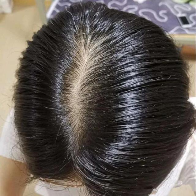 新生儿掉头发正常吗