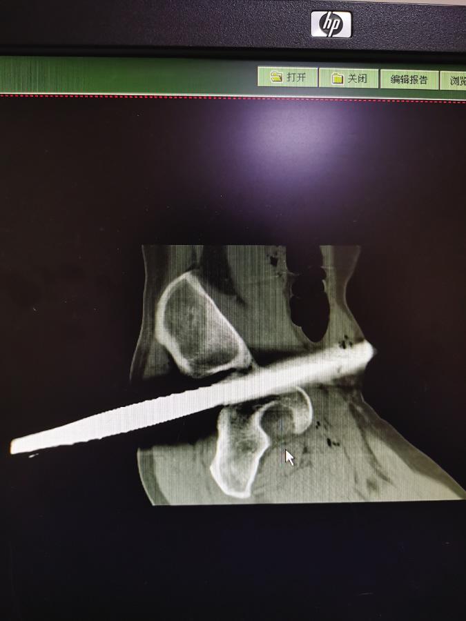 钢筋有哪些常见直径