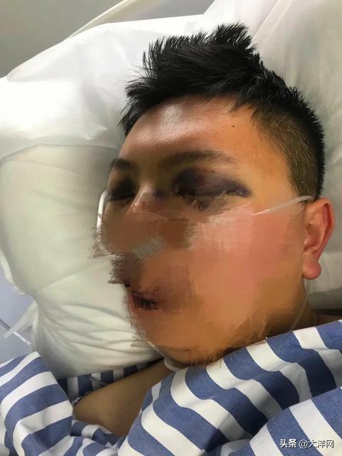 新冠病毒可能成为流行性病毒吗