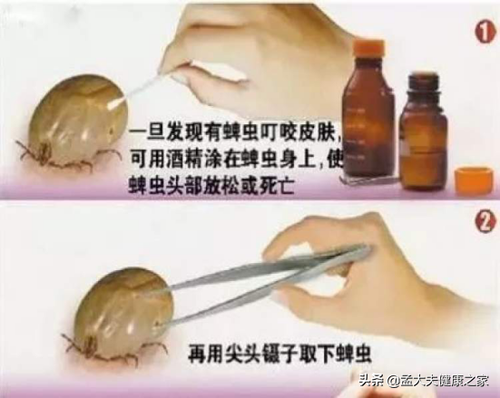 ​宝宝被宠物咬伤怎么急救