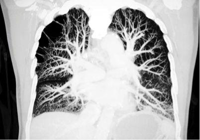 临床医学期刊查询哪个医学类核心期刊审稿时间短