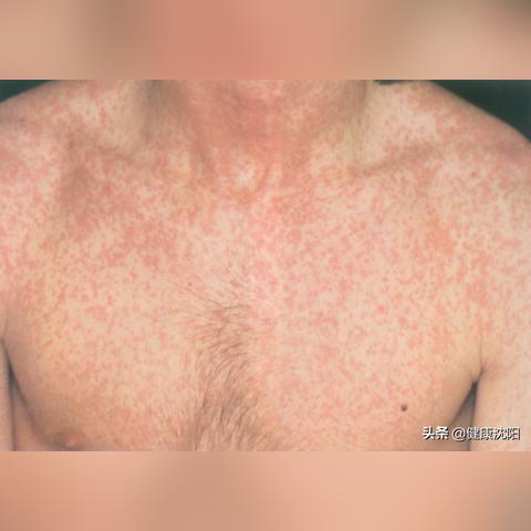 沈阳皮肤堂相关长尾关键词有哪些