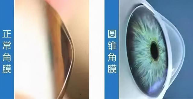 宝宝频繁揉眼是什么