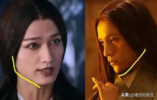 额头的宽窄真的跟聪明有关吗