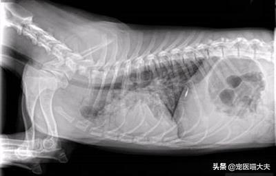 新生儿吸入性肺炎病因与预防