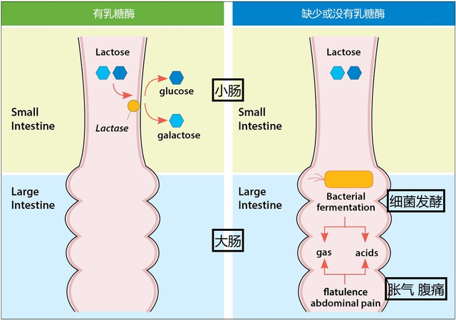 牛奶蛋白过敏和乳糖不耐受的区别