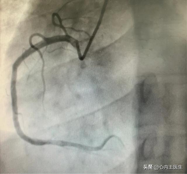 孕中期遭遇急性腹泻的悲惨经历