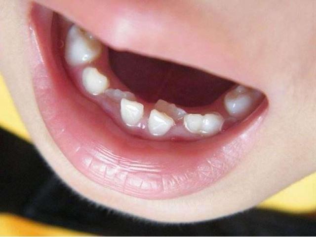 如何让宝宝“吃”出一口好牙？盘点对牙有益的食物
