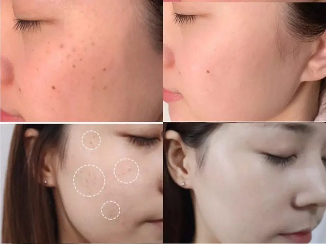 最好的抗衰老的方法是什么