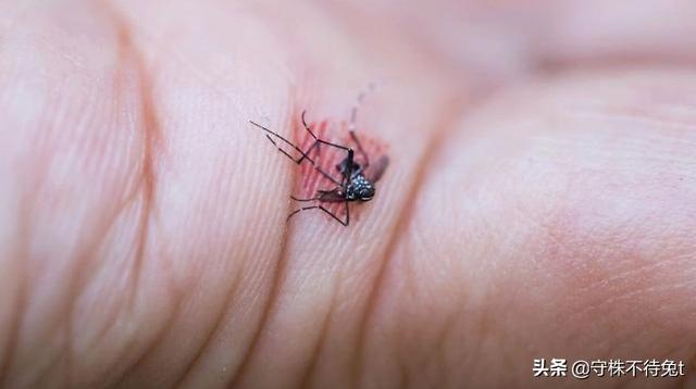 蚊子叮在身体的哪个部位最痒 蚊子叮在身体的哪个部位最痒