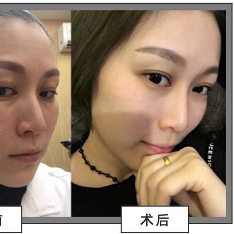 杭州美容祛斑的相关长尾关键词有哪些