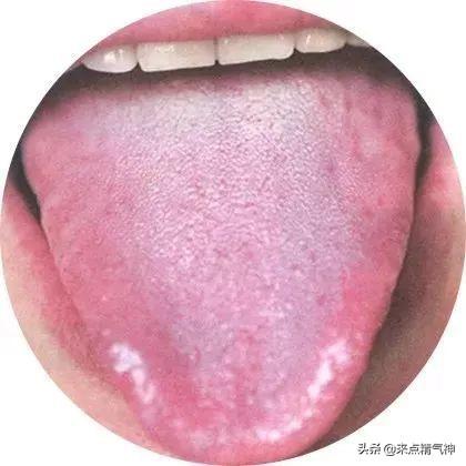 从舌头怎么看孩子身体状态