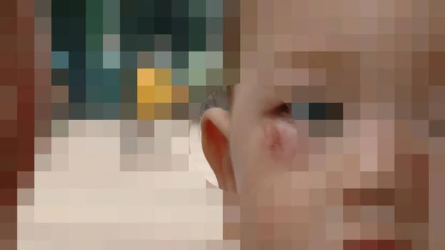 孩子挫伤怎么处理比较好