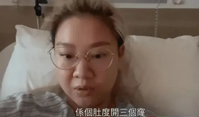 引流要开刀吗 开刀引流痛吗