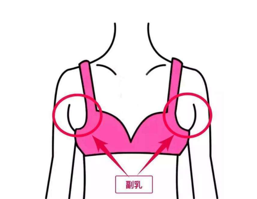怎么判断腋下是副乳还是赘肉