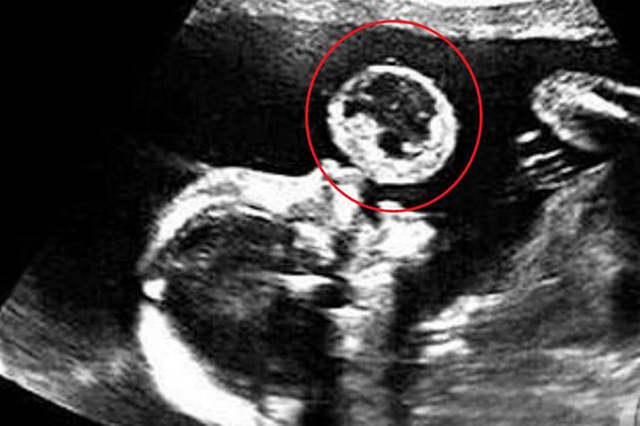 宝宝什么时候会吐泡泡 宝宝什么时候会吐泡泡