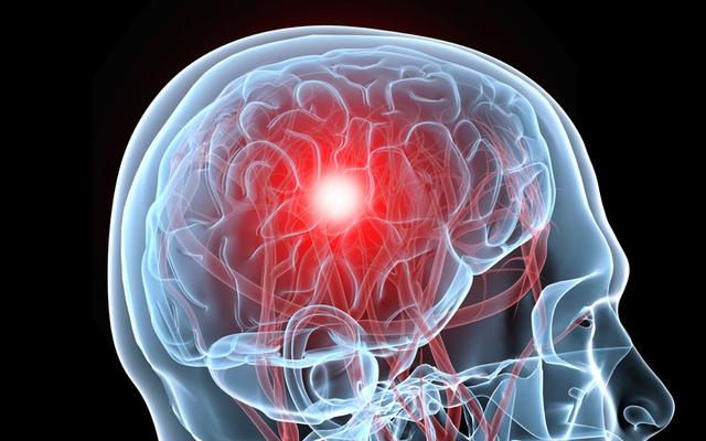 眼睛也会中风吗 眼睛也会中风吗