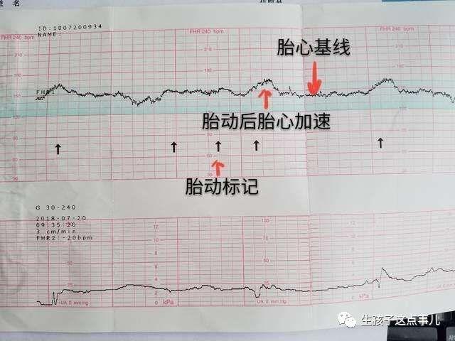 宝宝的健康情况