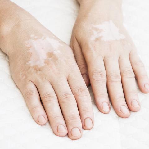 邻苯二酚(邻苯二酚还是邻二苯酚) 邻苯二酚(邻苯二酚还是邻二苯酚)